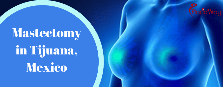 Mastectomy Breast Cancer Treatment in Tijuana, Mexico